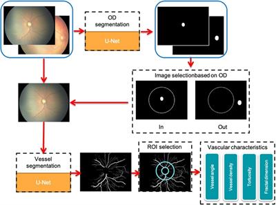 Vessels characteristics in familial exudative vitreoretinopathy and retinopathy of prematurity based on deep convolutional neural networks